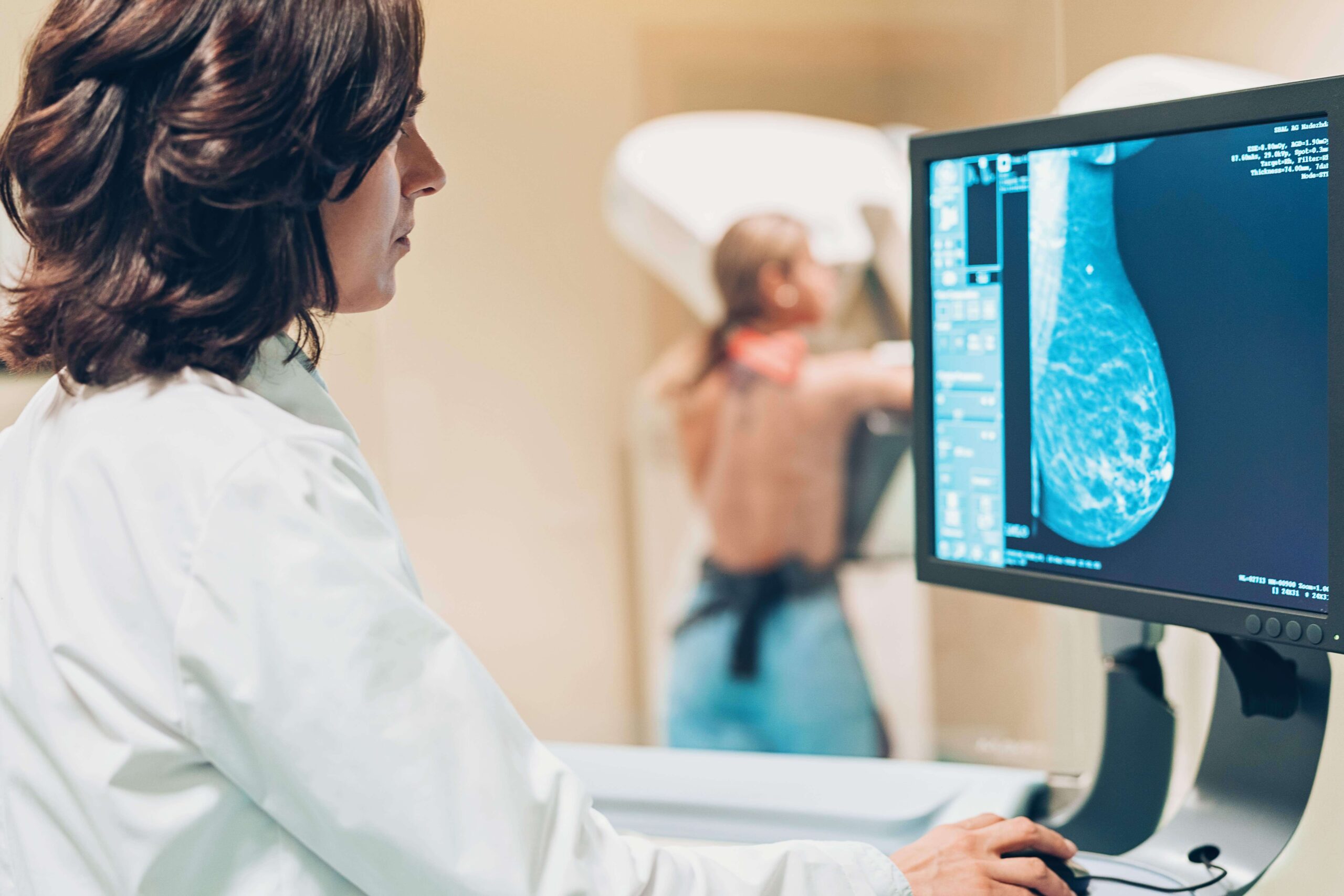 Breast screening